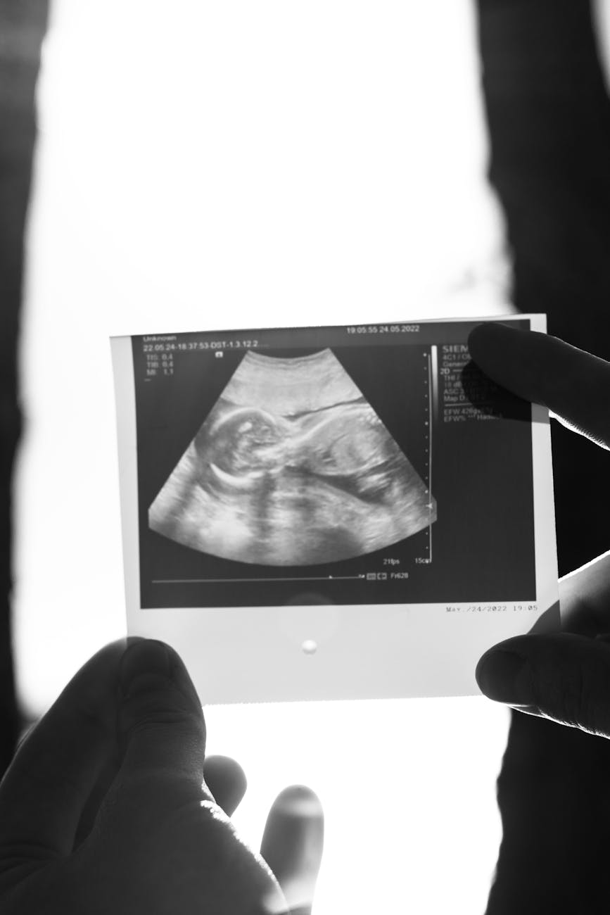 Ultrasound scan